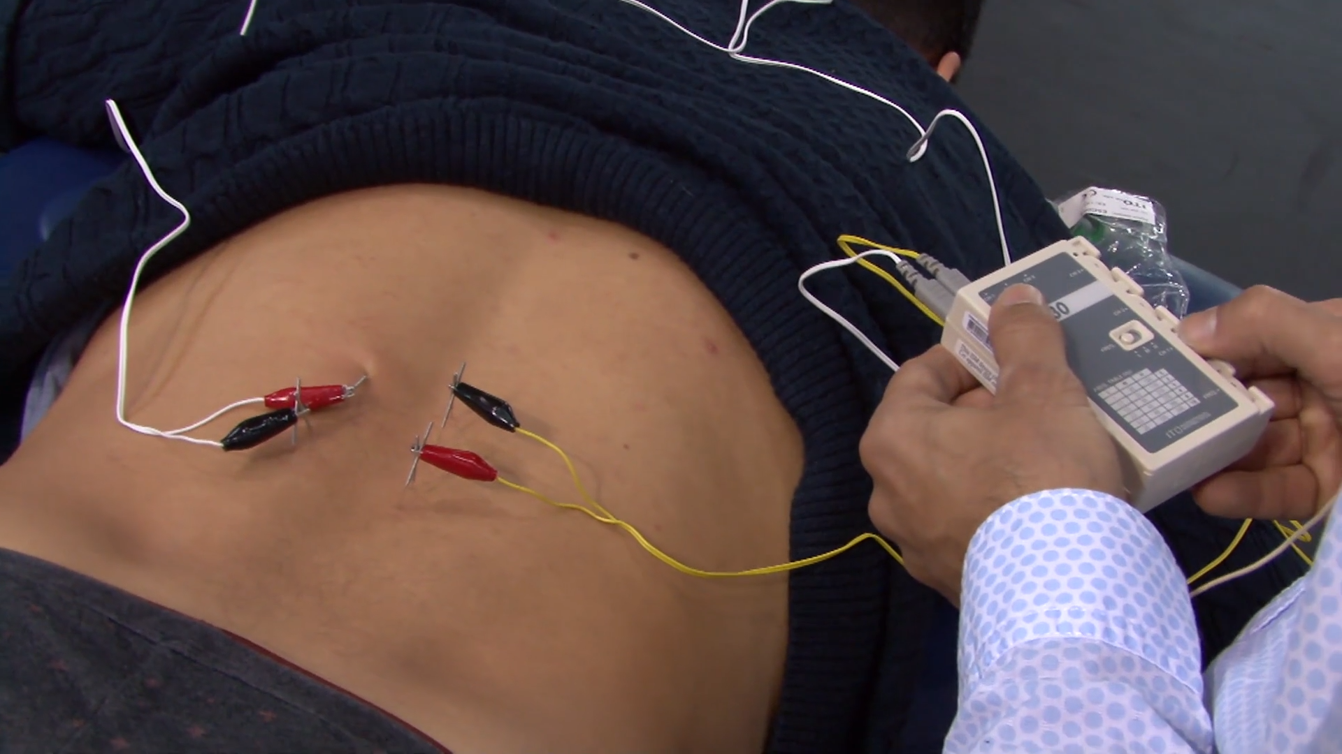 Neuromodulación Fisioterapia Invasiva